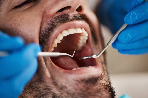 Best Emergency Care for Gum Disease in Quincy, MI