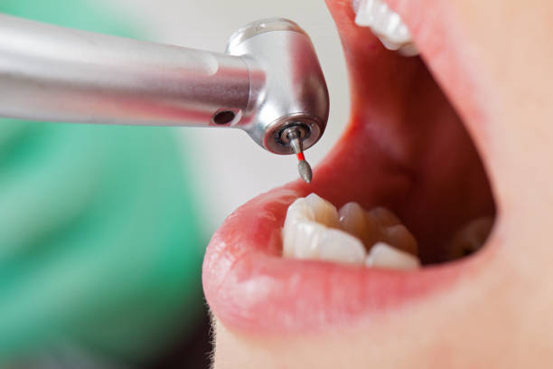 Best Emergency Treatment for Oral Infections in Quincy, MI